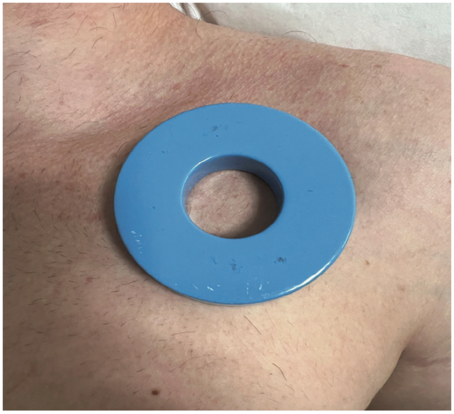 If You Are Not Sure the Pacemaker is Working, Do Not the